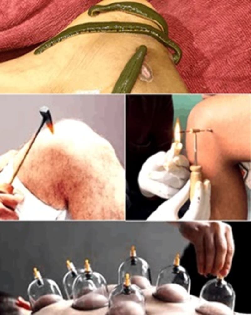 Anushastra Treatments in Ayurveda Anushastra Treatments in Ayurveda